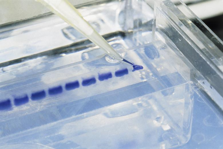 高分子量条带_爱津生物